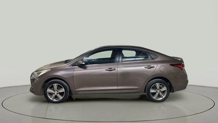 2017 HYUNDAI VERNA