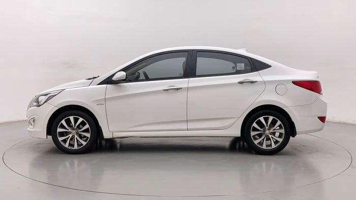 2017 Hyundai Verna