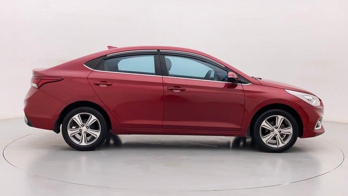 2018 Hyundai Verna