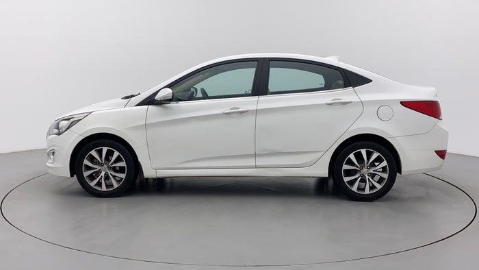 2017 Hyundai Verna