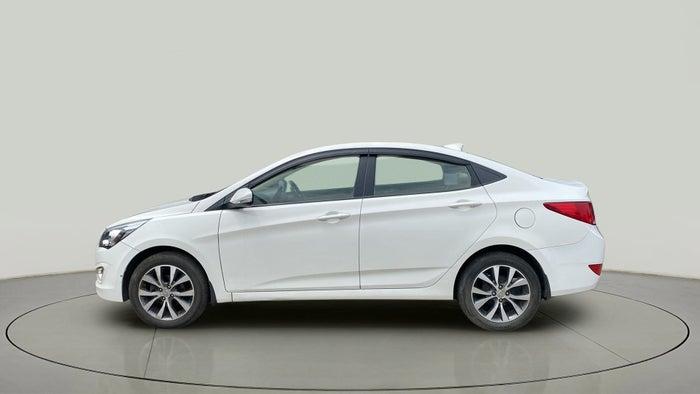 2017 HYUNDAI VERNA