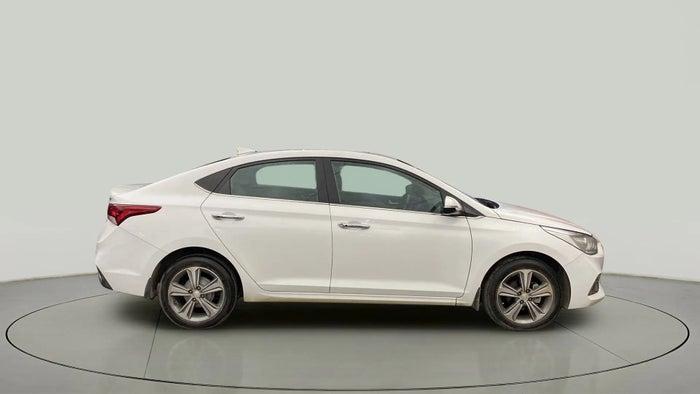 2017 Hyundai Verna