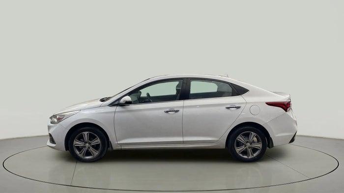 2017 Hyundai Verna