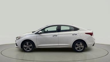 2017 Hyundai Verna