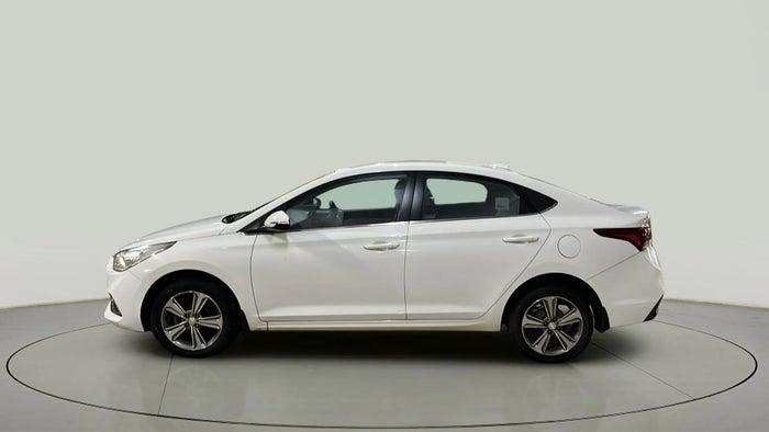 2017 Hyundai Verna