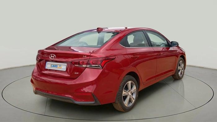 2017 Hyundai Verna