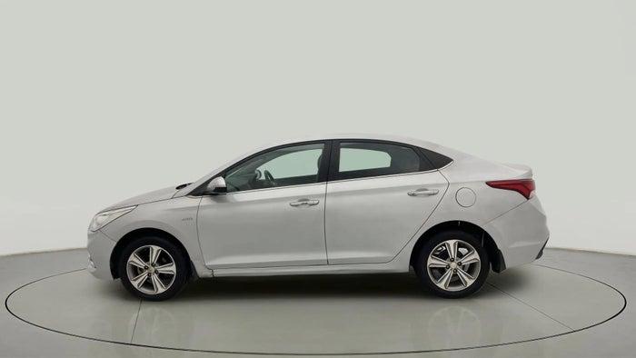 2017 Hyundai Verna