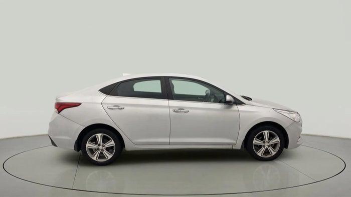 2017 Hyundai Verna